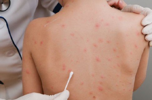 Which Hospital Offers the Best Pediatric Infections Treatment in Faridabad?